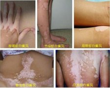 տó 综